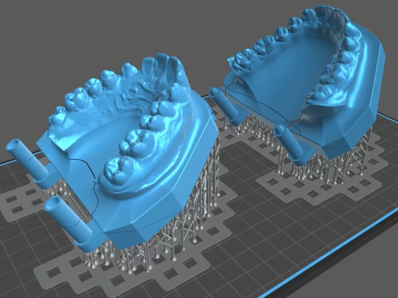 Modèles dentaires issus d'un scan 3D, préparés pour l'impression en résine avec leurs supports